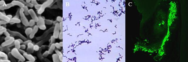 2.4 Propionibacterium acnes Propionibacterium acnes je bakterie, která je běžně součástí mikroflóry kůže, ústní dutiny, vnějšího zvukovodu, spojivky a tlustého střeva.
