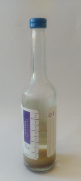 Zásady správného odběru hemokultur Dostatečné množství krve Jednorázový odběr Periférie - 40 až 60 ml krve (10 ml na lahvičku; celkem 4 až 6 lahviček) - jednorázový