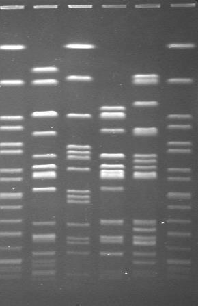 PFGE endonukleázy vzácně štěpící rozpoznávají a štěpí sekvence, které se v genomové DNA vyskytují zřídka