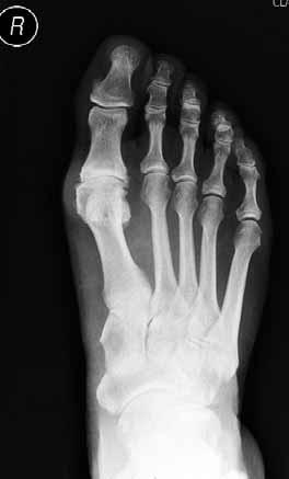 457/ Acta Chir Orthop