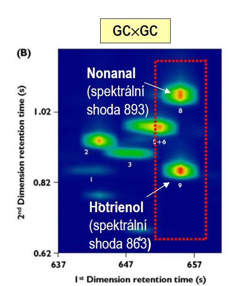 processing by artificial neural