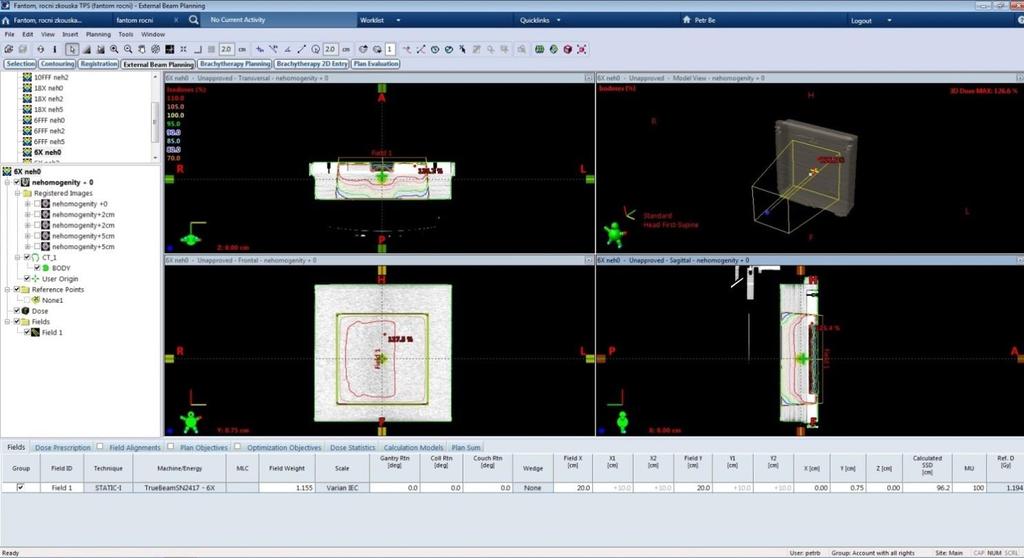 Eclipse je rozdělen do různých aplikací Selection, External Beam Planning a Plan Evaluation. Aplikace Selection slouží pro importování a tvorbu snímků.