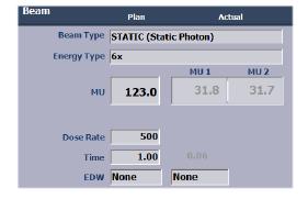 3.2.2.7 Kontrola nastavení svazku záření Obr. 14: Parametry svazku na obrazovce Treatment [18] Parametr svazku Popis Beam Type (Typ svazku) Typ ozařování.