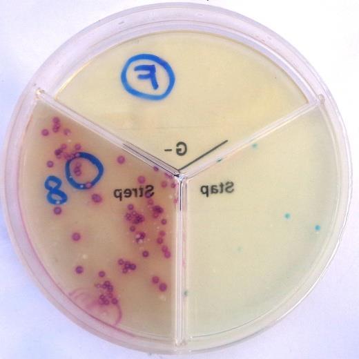 Bacillus pumilus