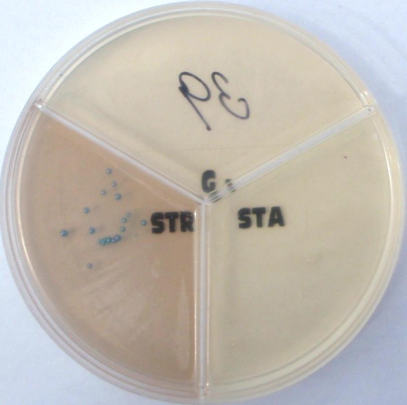 . Streptococcous agalactiae - Na PM testu roste v světlemodrých koloniích na STR sektoru -