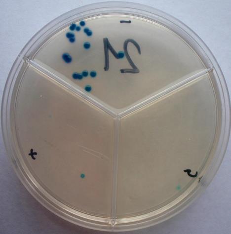 Escherichia coli