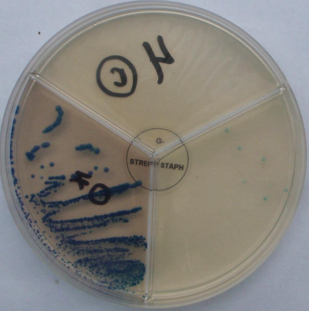 Streptococcus uberis Proč je standartní léčba Streptococus uberis neúspěšná? A.