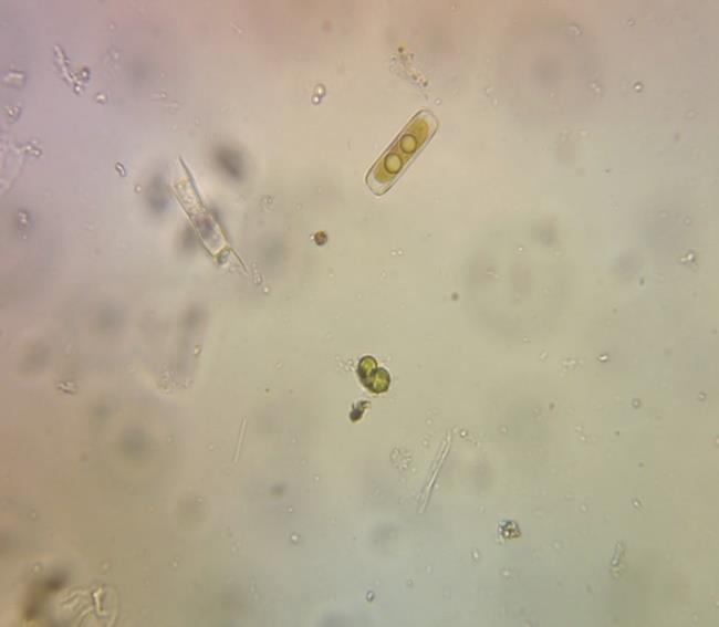 Vodní fauna - čolek larva občasně - čolek obecný ojediněle - makovka hojně - plavčík (Bi 5) ojediněle - plovatka bahenní (Bi