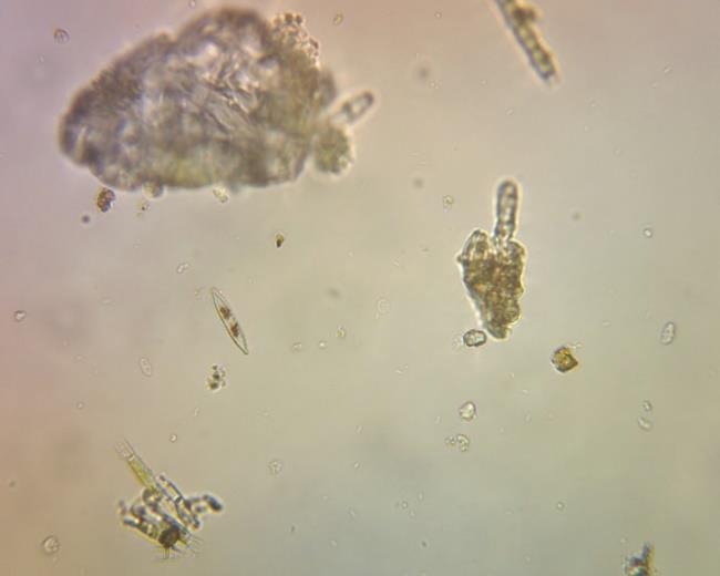 986' Biotický index = 4 T = 7,9± 0,13 C (sr = 0,75 %) K = 317± 0,0 μs/cm (sr = 0,00 %) Potůček cca 150m od pramene.