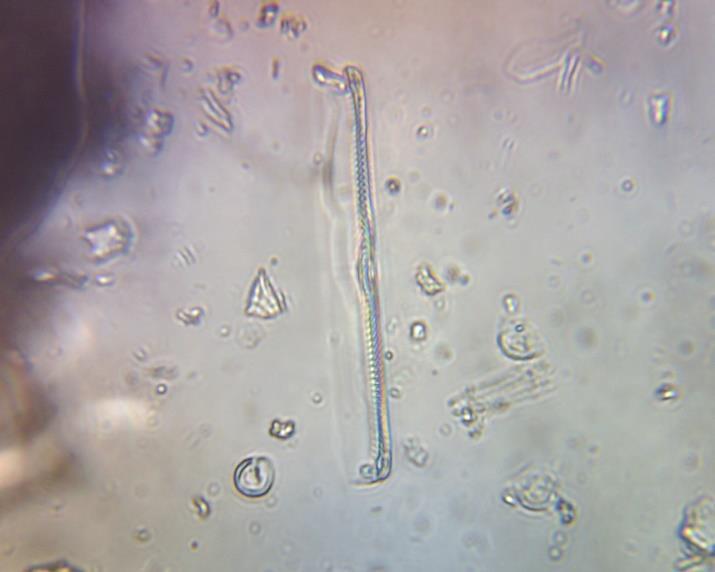 Vodní fauna - hlístice ojediněle - chrostík larva (Bi 7) občasně - komár larva (Bi 2) ojediněle -