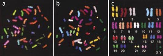 Molekulární patologie-metodologie Spectral karyotype imaging (SKI) (a) Displayové barvy (b)