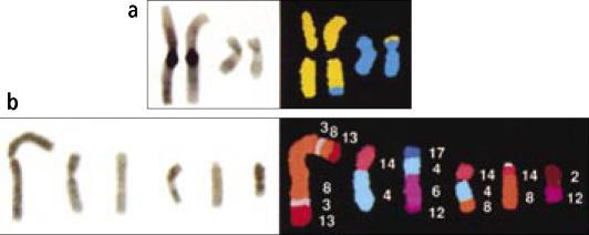 Molekulární patologie-metodologie Spectral karyotype imaging: (a)