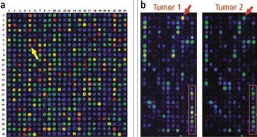 (a) DNA microarray reader ukazuje fluorescenční intenzity různých cdna.