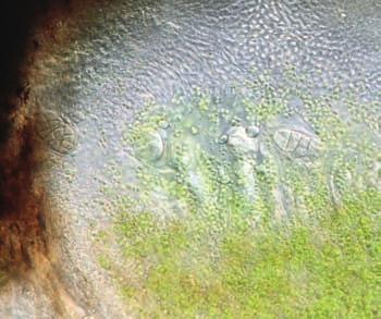21), ústěnku Levierovu (Solenostoma confertissimum), řetízkovec skalní (P.