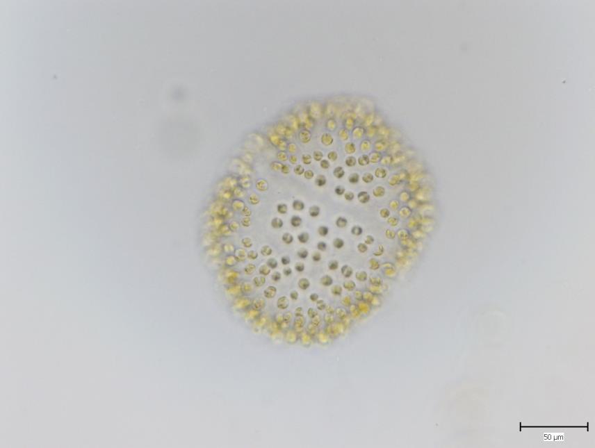 Zlativky (Chrysophyceae)
