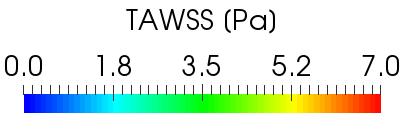 index: výrazná oscilace proudu (OSI > 0,3) extrémní hodnoty WSS v oblasti našití štěpu (místy