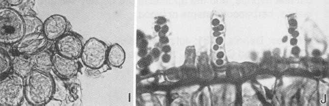 Třída: TAPHRINOMYCETES řád Taphrinales, čeleď Taphrinaceae - taktéž parazité, liší se od předchozích tříd (i od druhé čeledi v této třídě) tvorbou dikaryotického parazitického mycelia haploidní fáze