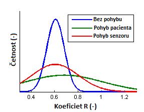 Obrázek 2.8: Ukázky různého zkreslení signálu různými exogenními vlivy [8] 2.6.