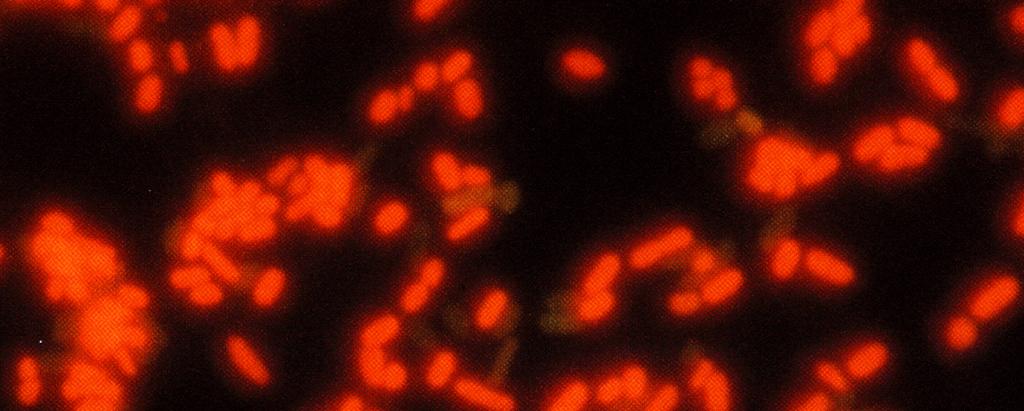 Metody s přímým p počítáním bakteriáln lních buněk DEFT