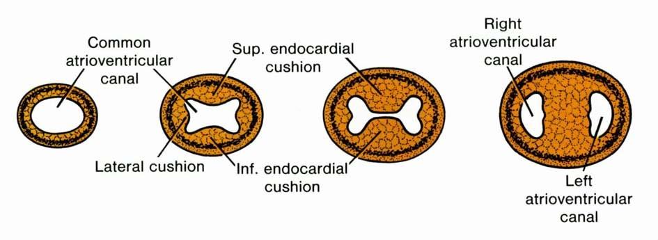 vývoj endokardových návalků