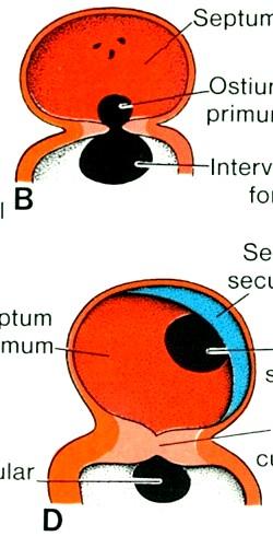 vývoj interatriálního septa septum primum,, v jeho dolní části foramen primum,,