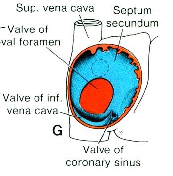 mechanismem apoptózy foramen secundum septum secundum (vpravo od s.