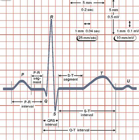 Komplex QRS odráží depolarizaci komor. První negativní kmit komplexu QRS komplexu se označuje jako vlna Q, první pozitivní jako vlna R a další negativní kmit následující po vlně R, jako vlna S.