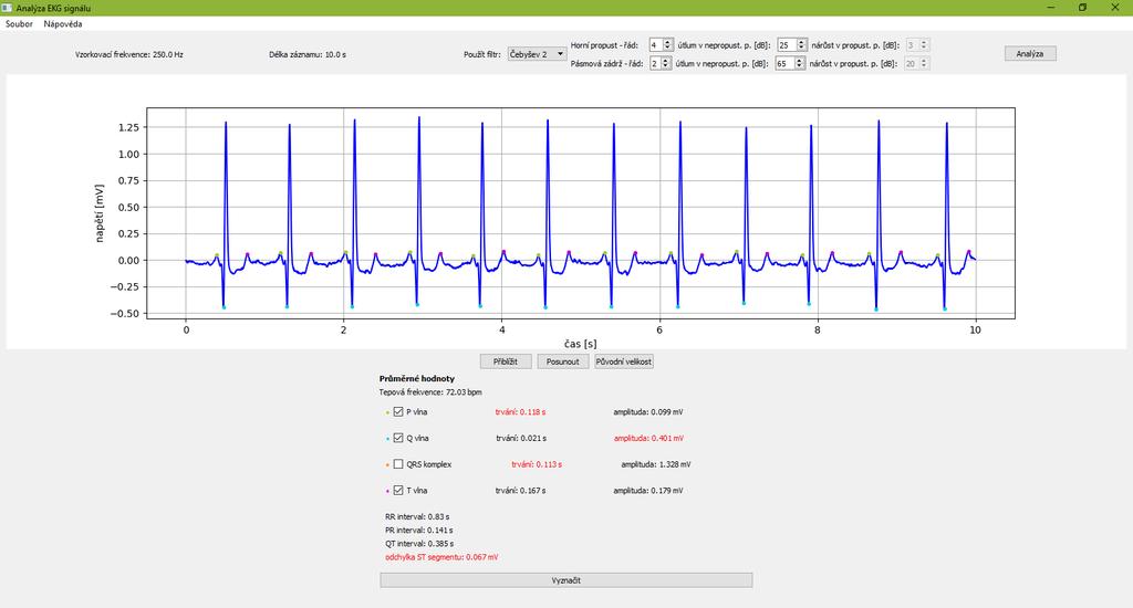 Obrázek 7.2: Hlavní okno po načtení signálu a provedení analýzy příslušnou barvou. Obrázek 7.