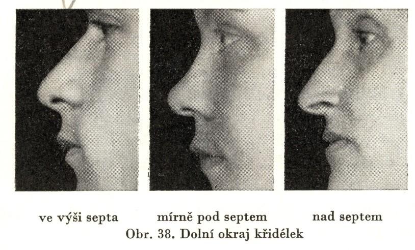 Dolní okraj křidélek ve vztahu k septu: 1. ve výši septa, 2. pod septem, 3.