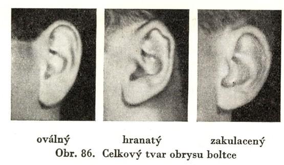 Je dáno nadušní výškou hlavy. Celkový tvar obrysu boltce: 1. oválný, 2.