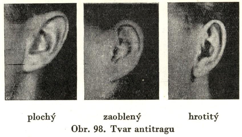 jednohrbolový, 2. dvouhrbolový Velikost antitragu: 1.