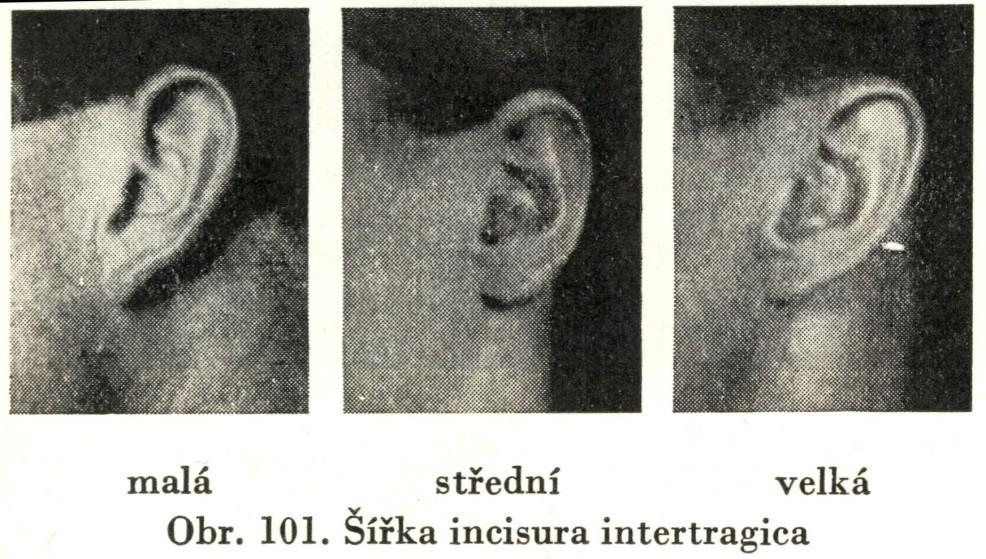 střední, 3. velká Velikost lalůčku: lalůček je 1. malý, 2.