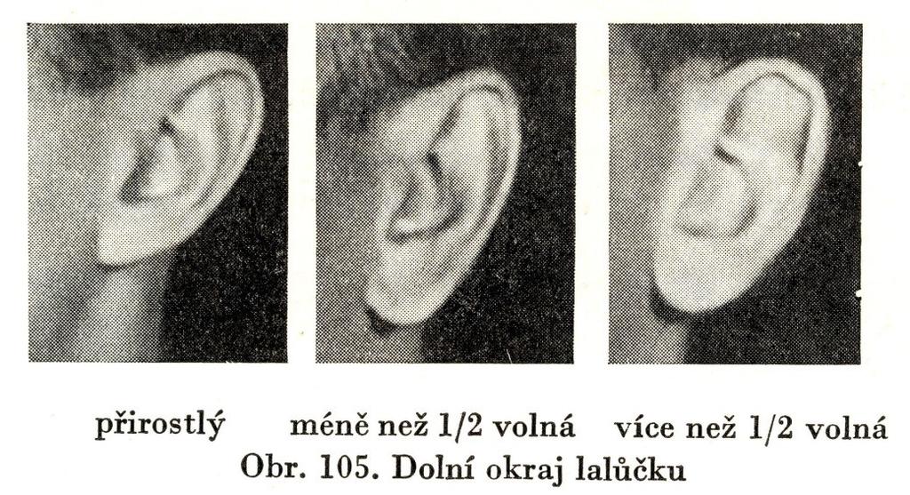 středně vyčnívající do stran, 4.