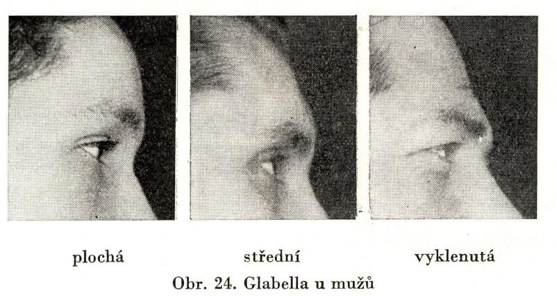 střední, 3. silně vytvořené Glabella: 1. plochá, 2.
