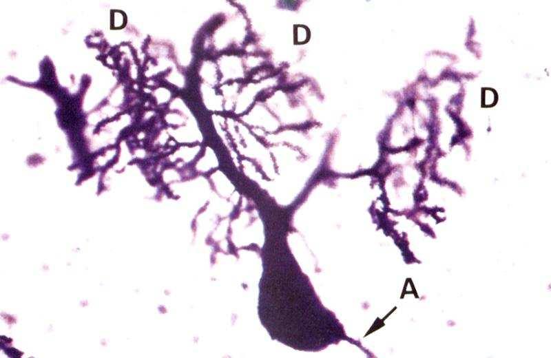 A. Dendrity Výběžky, které přijímají vstupní informaci (receptivní segment neuronu), označujeme jako dendrity.