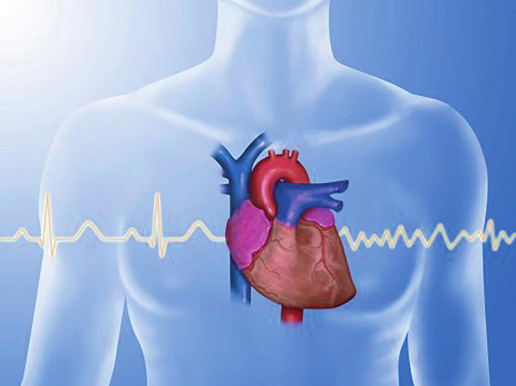 32 AKTUALITY Diagnostika i léčba fibrilace srdečních síní má stále mezery Fibrilace srdečních síní je jednou z nejběžnějších poruch srdečního rytmu.