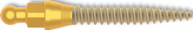 KOS MINI IMPLANTÁTY 5,4 mm 5,4 mm 5,4 mm KOS Mini 1.8 10 KOS Mini 1.8 12 KOS Mini 1.8 15 10 mm 12 mm 15 mm Barevné ochylky implantátů s povrchem No-Itis nemají žádný vliv na kvalitu. Max.