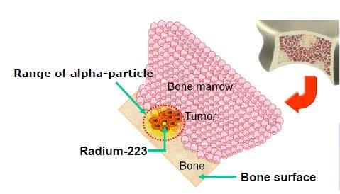 Rádium-223 dichlorid (Ra-223) Ra-223 imituje kalcium inkorporace do buňky kostních metastáz Emiter alfa záření = vysoká dávka radiace na krátkou vzdálenost (2-10 buněk) Cíleně ničí buňky kostních mts