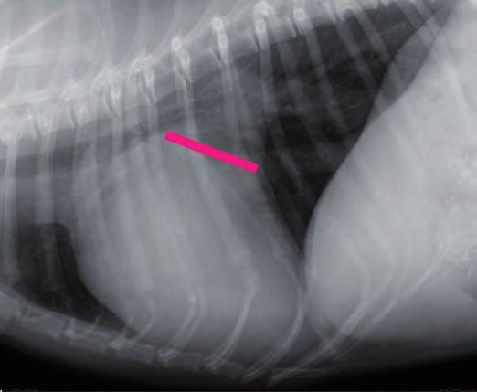 Nediagnostikovaná hypotyreóza může nicméně zhoršovat klinické příznaky srdeční choroby. PŘÍZNAKY Klinickou progresi DCM nejlépe vystihují dvě odlišné fáze.