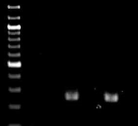 = velikostní standard 100 bp DNA ladder. Obr. 10 Obr. 11: Amplifikace specifického PCR produktu o velikosti 254 bp pro alelu Rht-D1b.