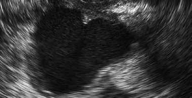 Získaním majoritného podielu v Nemocnici Zlaté Moravce sa stáva v poradí 9 zdravotníckym zariadením skupiny AGEL SK, ktorá chce ponúknuť kvalitnú a komplexnú zdravotnú starostlivosť a taktiež zázemie