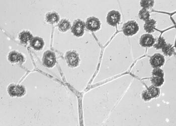 Řád: ZOOPAGALES Cenocytické mycelium nebo pouze stočená hyfa, nepohlavní