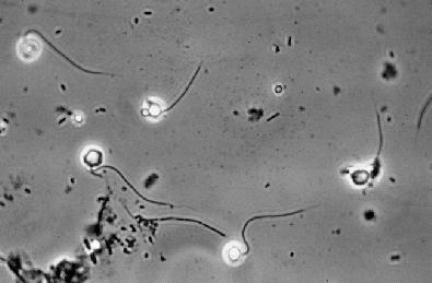 Řád: SPIZELLOMYCETALES Stélka primitivní,