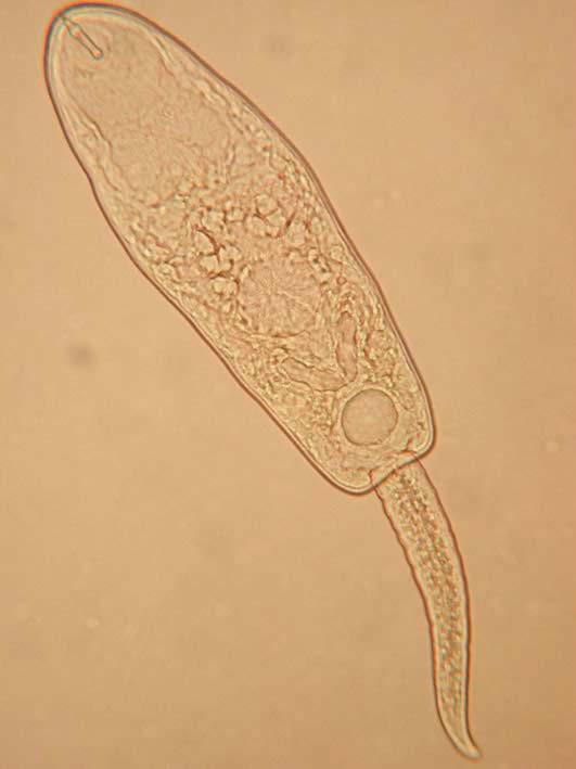 17. Obrázek typické xiphidiocerkárie