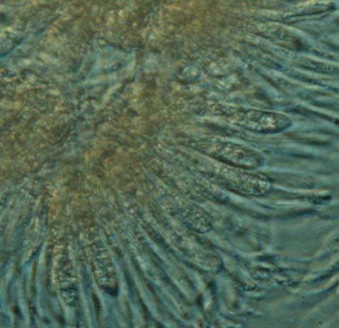 Interaskální struktury hamathecium - sterilní mycelium mezi vřecky parafýzy prodloužené cylindrické hyfy vycházející z bází askokarpů a