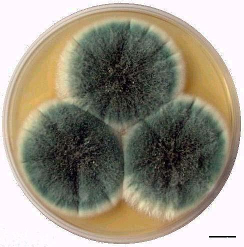 produkuje mykotoxiny fumitremorginy, verruculogen a gliotoxin