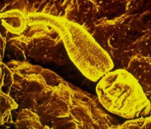 Schistosomy rodu Trichobilharzia nespecifický hostitel: savec (vč.
