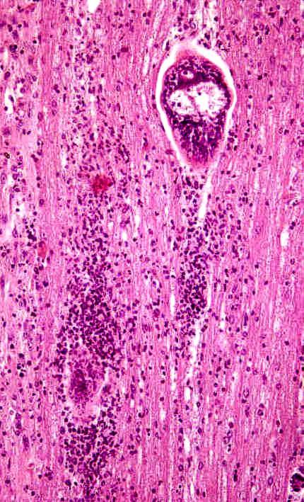 Schistosomy rodu Trichobilharzia v nespecifickém hostiteli