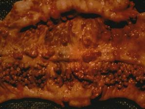 intercalatum histologie,