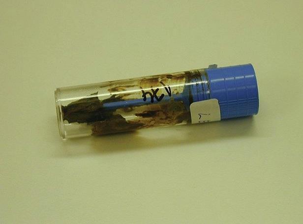 DIAGNOSTIKA OPTIMÁLNÍ: a) průkaz vajíček